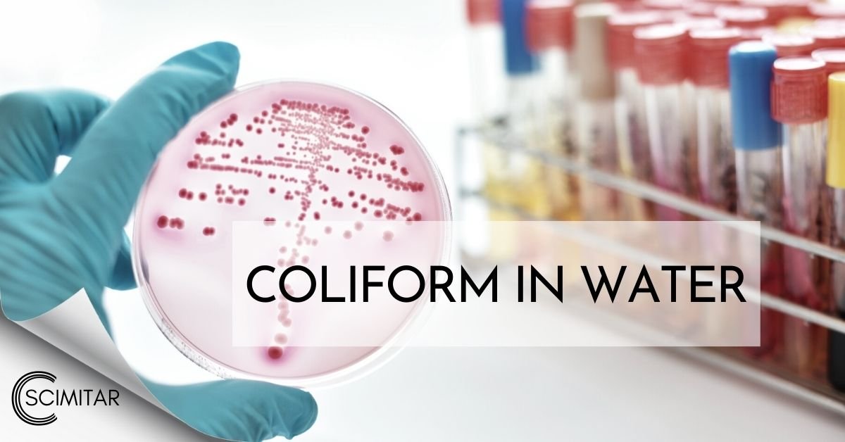 You are currently viewing Vi khuẩn Coliform trong nước và cách xử lý